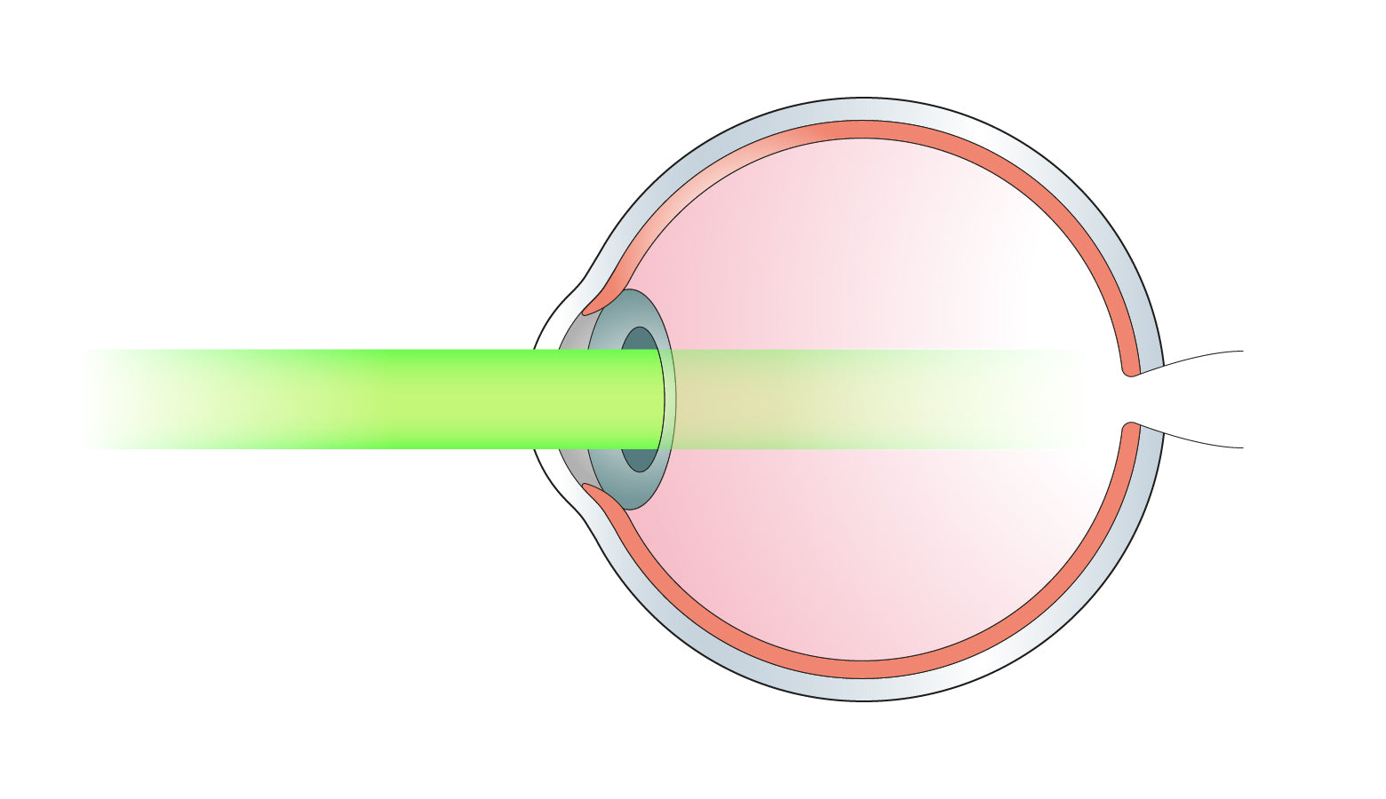 Biological Impacts From Lasers